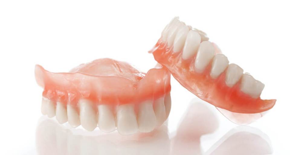 What Are the Benefits of Dental Implants?