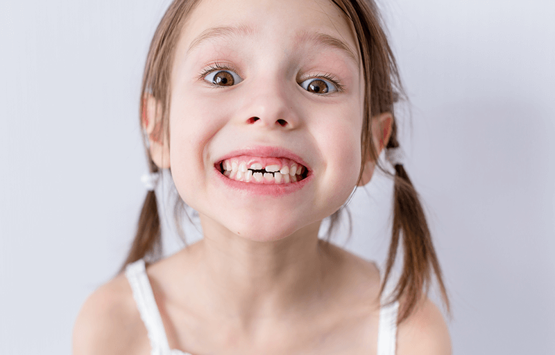 Root Canal Treatment for Kids